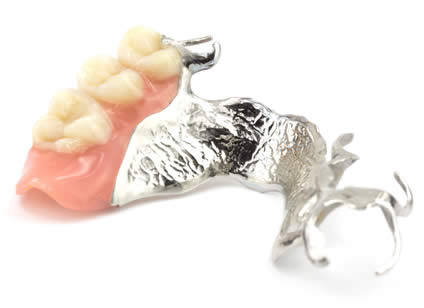 Partial Dentures