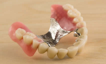 Partial Dentures