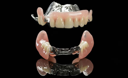 Partial Dentures
